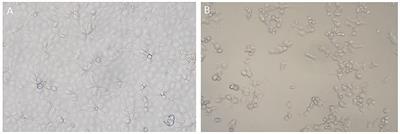 Molecular epizootiology of porcine reproductive and respiratory syndrome virus in the Xinjiang Uygur Autonomous Region of China